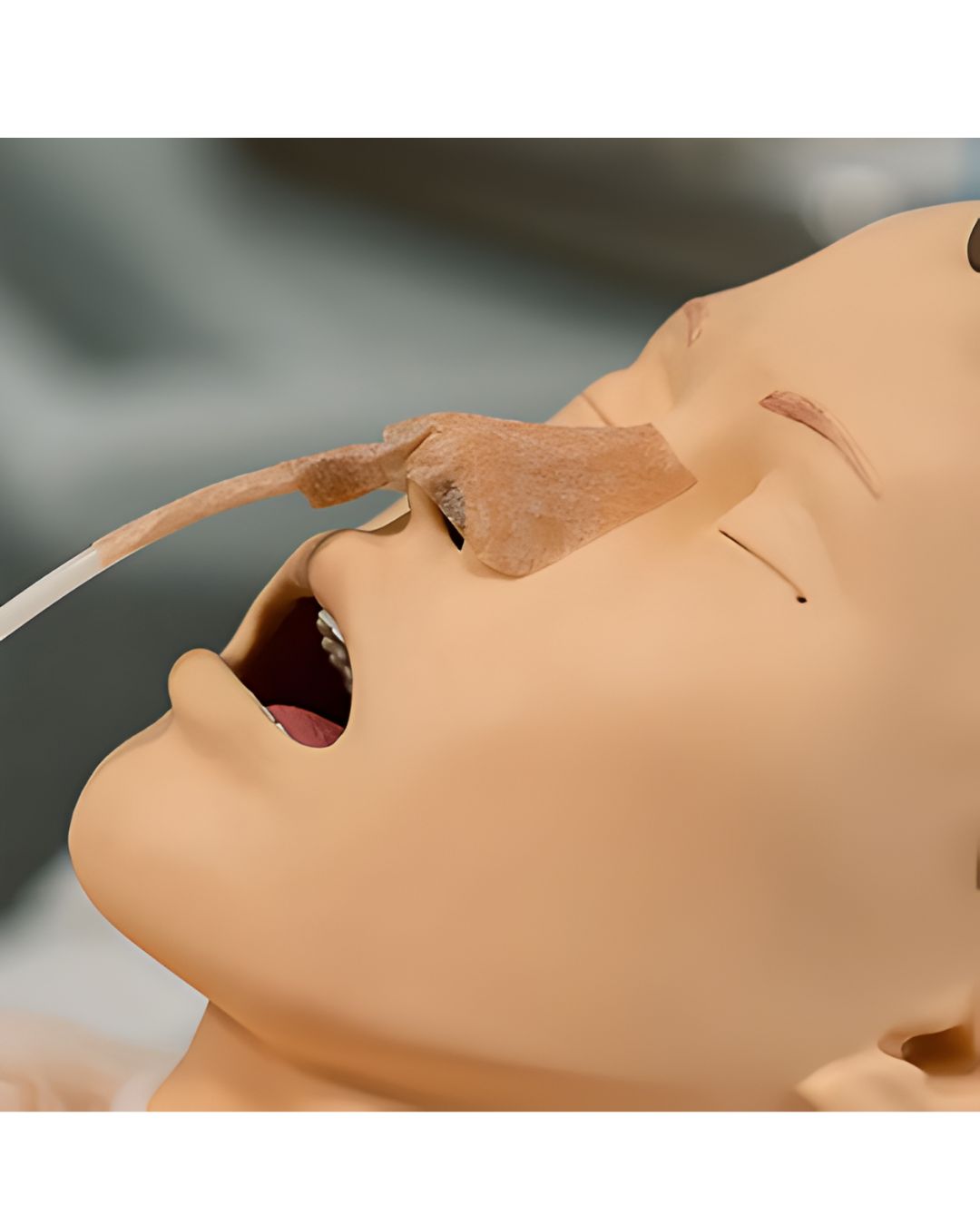 Helpfix Fixador P/ Cateter e Sonda Nasal c/10 Unidades - AMP + E-book