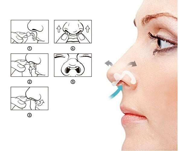 Dilatador Nasal Interno Teste 2 Und M/G FluxAir