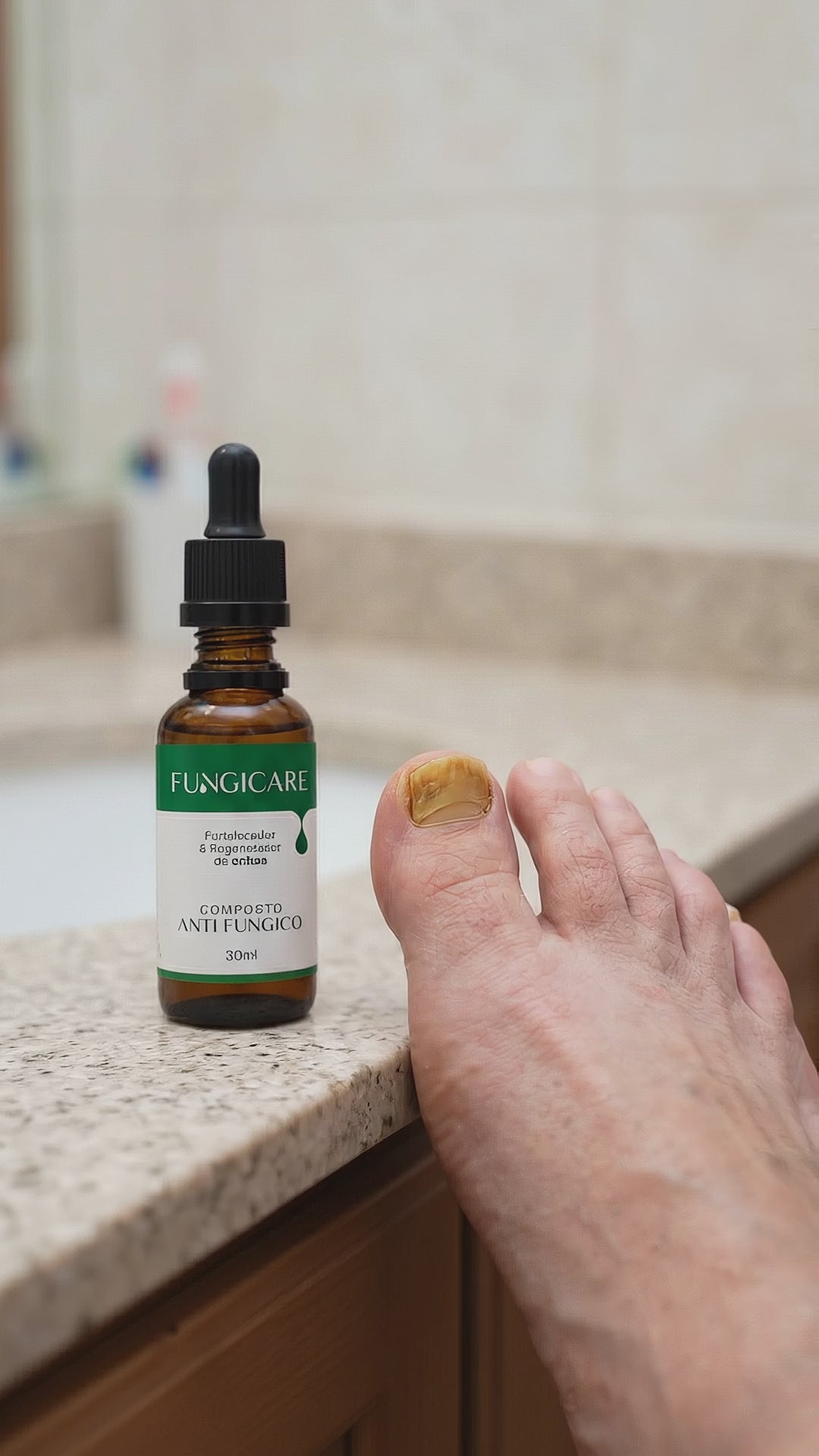 Fungicare - Óleo Pronto Para Fungos Pé 30ml - Botanicare + E-book