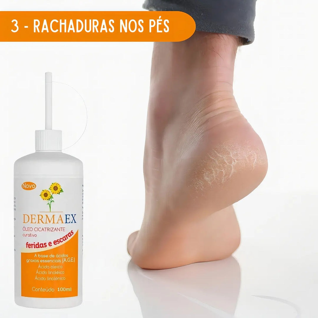 DermaEx - Óleo Cicatrizante Curativo 100ml Nutriex + E-book