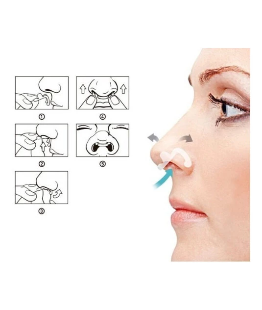 Dilatador Nasal Interno Teste 2 Und M/G FluxAir
